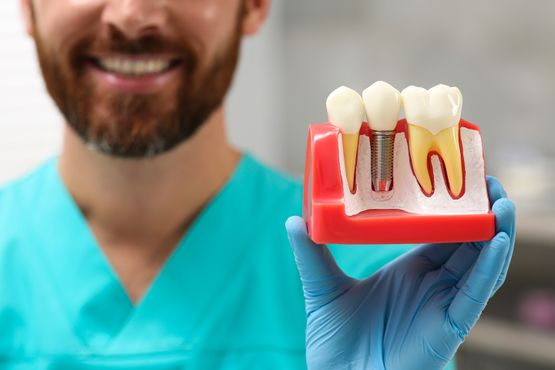 Clínica Dental Primavera pareja sonriendo
