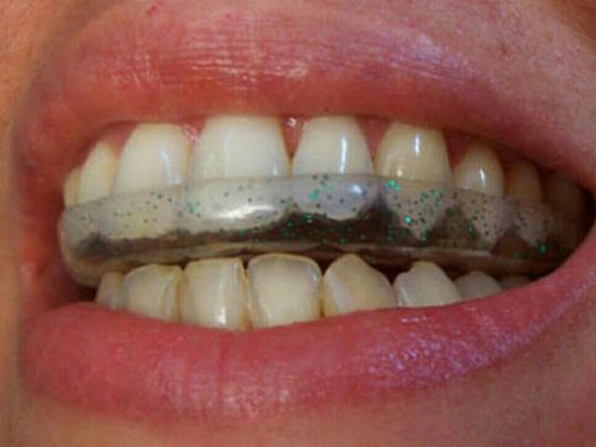 Clínica Dental Primavera tratamiento para el bruxismo